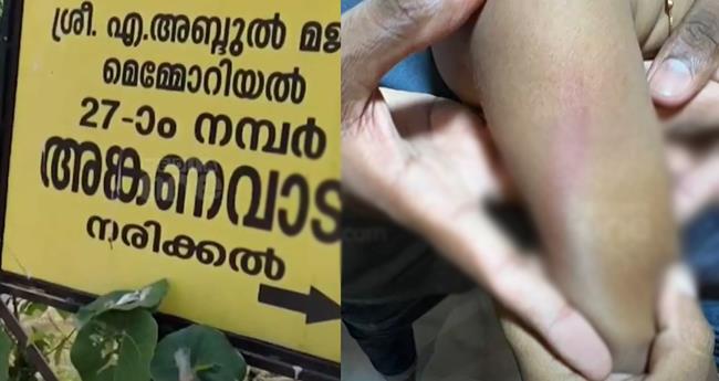 ര​ണ്ട​ര വ​യ​സു​കാ​രി​യെ ക​മ്പി കൊ​ണ്ട് അ​ടി​ച്ച സം​ഭ​വം; അ​ങ്ക​ണ​വാ​ടി ടീ​ച്ച​ർ​ക്ക് സ​സ്പെ​ൻ​ഷ​ൻ
