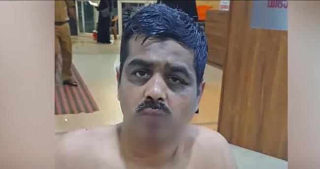 കൊ​യി​ലാ​ണ്ടി​യി​ല്‍ പ്ര​തി​യു​ടെ ആ​ക്ര​മ​ണം; മൂ​ന്ന് പോ​ലീ​സു​കാ​ര്‍​ക്ക് പ​രി​ക്ക്