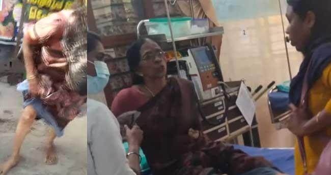 സ്ലാ​ബു​ക​ൾ​ക്കി​ട​യി​ൽ കാ​ൽ കു​രു​ങ്ങി വ​യോ​ധി​ക​യ്ക്ക് പ​രി​ക്ക്