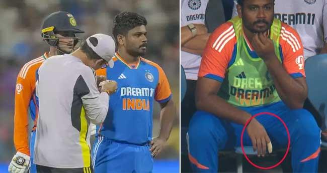 കൈ​വി​ര​ലി​ന് പ​രി​ക്ക്: സ​ഞ്ജു​വി​ന് ആ​റാ​ഴ്ച വി​ശ്ര​മം, ര​ഞ്ജി മ​ത്സ​രം ന​ഷ്ട​മാ​യേ​ക്കും