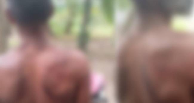 പാ​ല​ക്കാ​ട്ട് ചു​മ​ട്ടു​തൊ​ഴി​ലാ​ളി​ക്ക് സൂ​ര്യാ​ഘാ​ത​മേ​റ്റു