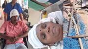 കൊല്ലത്ത് ഇരുമ്പുകമ്പി തലയിലേക്ക് വീണ് അപകടം; പരിക്കേറ്റവരെ തിരിച്ചറിഞ്ഞു