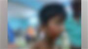 പാ​ല​ക്കാ​ട്ട് ര​ണ്ടാം ക്ലാ​സു​കാ​ര​ന് തെ​രു​വു​നാ​യു​ടെ ക​ടി​യേ​റ്റു
