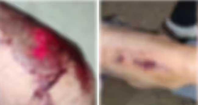 കാ​ട്ടു​പ​ന്നി​ക്കൂ​ട്ടം കു​റു​കെ ചാ​ടി; ഇ​രു​ച​ക്ര​വാ​ഹ​നം മ​റി​ഞ്ഞ് യു​വാ​വി​ന് പ​രി​ക്ക്