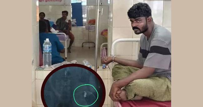 "തൊ​ണ്ടി​മു​ത​ലും ദൃ​ക്സാ​ക്ഷി​യും'; മോ​ഷ്ടാ​വ് വി​ഴു​ങ്ങി​യ മാ​ല പു​റ​ത്തെ​ടു​ക്കാ​നാ​വാ​തെ പോ​ലീ​സ്