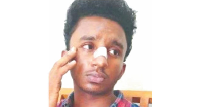 കൊയിലാണ്ടിയിലും എ​സ്എ​ഫ്ഐ​യു​ടെ മ​ർ​ദനം: വി​ദ്യാ​ർ​ഥി​ക്കു പ​രി​ക്ക്, കേ​സ്