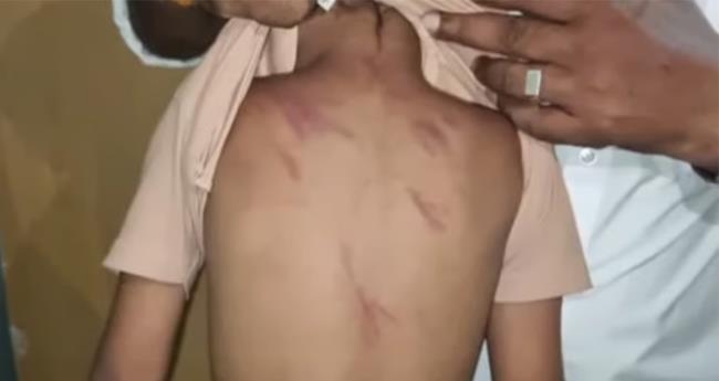 മ​ട്ടാ​ഞ്ചേ​രി​യി​ൽ പ്ലേ ​സ്കൂ​ൾ വി​ദ്യാ​ർ​ഥി​ക്ക് അ​ധ്യാ​പി​ക​യു​ടെ ക്രൂ​ര മ​ർ​ദ്ദ​നം