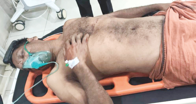 കാ​ട്ടാ​ന ആ​ക്ര​മ​ണം; ക​ർ​ഷ​ക​ന്‍റെ വാ​രി​യെ​ല്ലും   തോ​ളെ​ല്ലും ത​ക​ർ​ന്നു