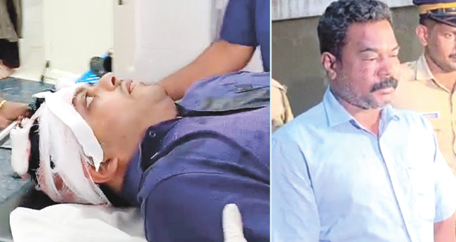 താ​മ​ര​ശേ​രി താ​ലൂ​ക്ക് ആ​ശു​പ​ത്രി​യി​ല്‍ ഡോ​ക്‌ടര്‍​ക്കു വെ​ട്ടേ​റ്റു ; ആക്രമിച്ചത് മ​​​സ്തി​​​ഷ്‌​​​കജ്വ​​​രം​​​ ബാ​​​ധി​​​ച്ചു മ​​​രി​​​ച്ച പെ​​​ണ്‍​കു​​​ട്ടി​​​യു​​​ടെ അ​​​ച്ഛ​​​ന്‍