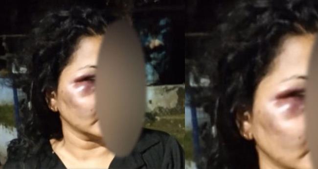 സെ‌​യി​ൽ​സ് ഗേ​ളി​നെ വീ​ടി​നു​ള്ളി​ൽ പൂ​ട്ടി​യി​ട്ട് മ​ർ​ദി​ച്ചു; സ്ഥാ​പ​ന ഉ​ട​മ അ​റ​സ്റ്റി​ൽ