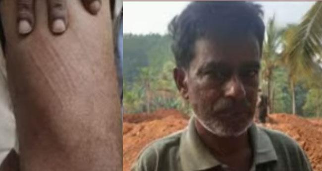 മ​ല​പ്പു​റത്ത് പു​ലി​യു​ടെ ആ​ക്ര​മ​ണ​ത്തി​ൽ ഒ​രാ​ള്‍​ക്ക് പ​രി​ക്ക്