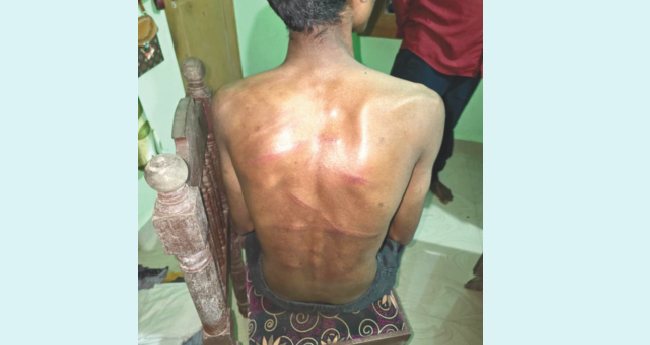 വിദ്യാര്‍ഥിയെ വീട്ടില്‍നിന്ന് വിളിച്ചിറക്കി കൊണ്ടുപോയി ക്രൂരമായി മർദിച്ചു
