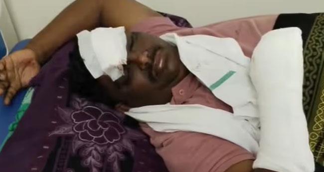 മ​ണ്ണാ​ർ​ക്കാ​ട്ട് കാ​ട്ടു​പ​ന്നി കു​റു​കെ ചാ​ടി പ​ഞ്ചാ​യ​ത്തം​ഗ​ത്തി​നു ഗു​രു​ത​ര പ​രി​ക്ക്