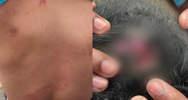 ജൂ​ണി​യ​ർ വി​ദ്യാ​ർ​ഥി​യെ സീ​നി​യേ​ഴ്സ് മ​ർ​ദി​ച്ച​താ​യി പ​രാ​തി