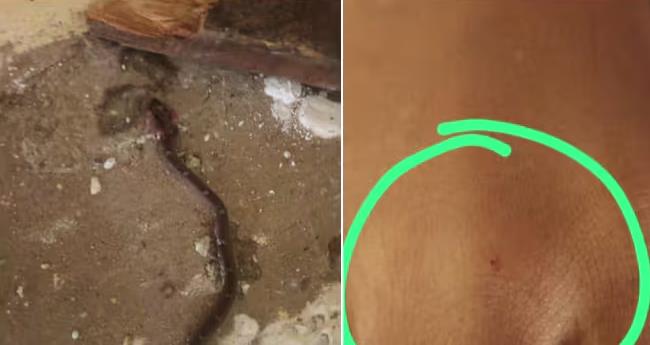 ക്ലാ​സ് മു​റി​യി​ല്‍​വ​ച്ച് വി​ദ്യാ​ര്‍​ഥി​നി​ക്ക് പാ​മ്പു​ക​ടി​യേ​റ്റു