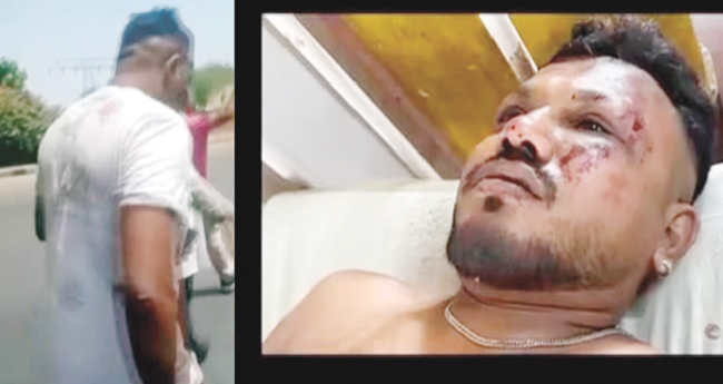 മ​ര​ണ​ത്തി​ന്‍റെ  തീ​വാ​തി​ൽ ക​ട​ന്നൊ​രാ​ൾ!  വി​ശ്വാ​സി​നും  അ​വി​ശ്വ​സ​നീ​യം