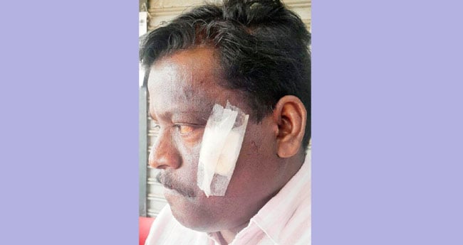 ബീവറേജസ് ഔട്ട്‌ലെറ്റിൽ സം​ഘ​ർ​ഷം;  ജീ​വ​ന​ക്കാ​ര​ന് പ​രി​ക്കേ​റ്റു
