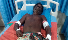കാ​ട്ടു​പ​ന്നി​യു​ടെ ആ​ക്ര​മ​ണ​ത്തി​ൽ തൊ​ഴി​ലാ​ളി​ക്ക് ഗു​രു​ത​ര​പ​രി​ക്ക്
