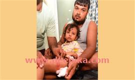 ഏ​ഴു വ​യ​സു​കാ​രി​യ​ട​ക്കം നാ​ലു​പേ​ർ​ക്ക്  തെ​രു​വു​നാ​യ​യു​ടെ ക​ടി​യേ​റ്റു