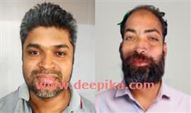 വ​യോ​ധി​ക​നെ  വെ​ട്ടി​ക്കൊ​ല​പ്പെ​ടു​ത്താ​ൻ  ശ്ര​മി​ച്ച ര​ണ്ടു പ്ര​തി​ക​ൾ അ​റ​സ്റ്റി​ൽ