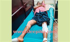 കാ​റി​ടി​ച്ച് സ്കൂ​ട്ട​ർ യാ​ത്ര​ക്കാ​ര​നു പ​രി​ക്ക്