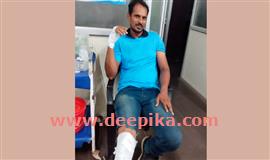സം​സ്ഥാ​ന​ പാ​ത​യി​ലെ  കു​ഴി​യി​ൽ ബൈ​ക്ക്  മ​റി​ഞ്ഞ് ര​ണ്ടു​പേ​ർ​ക്ക്  പ​രി​ക്ക്